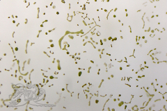 Knipskrakes-Bino-20241031154430533x