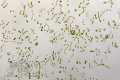 Knipskrakes-Bino-20241031154556708x