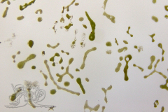 Knipskrakes-Bino-20241031154628410x