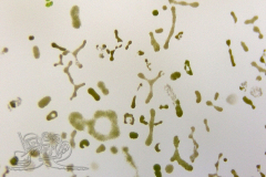 Knipskrakes-Bino-20241031154725221x